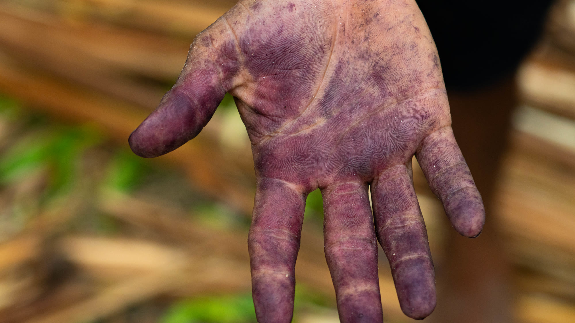 Palma da mão tingida de roxo pelo açaí